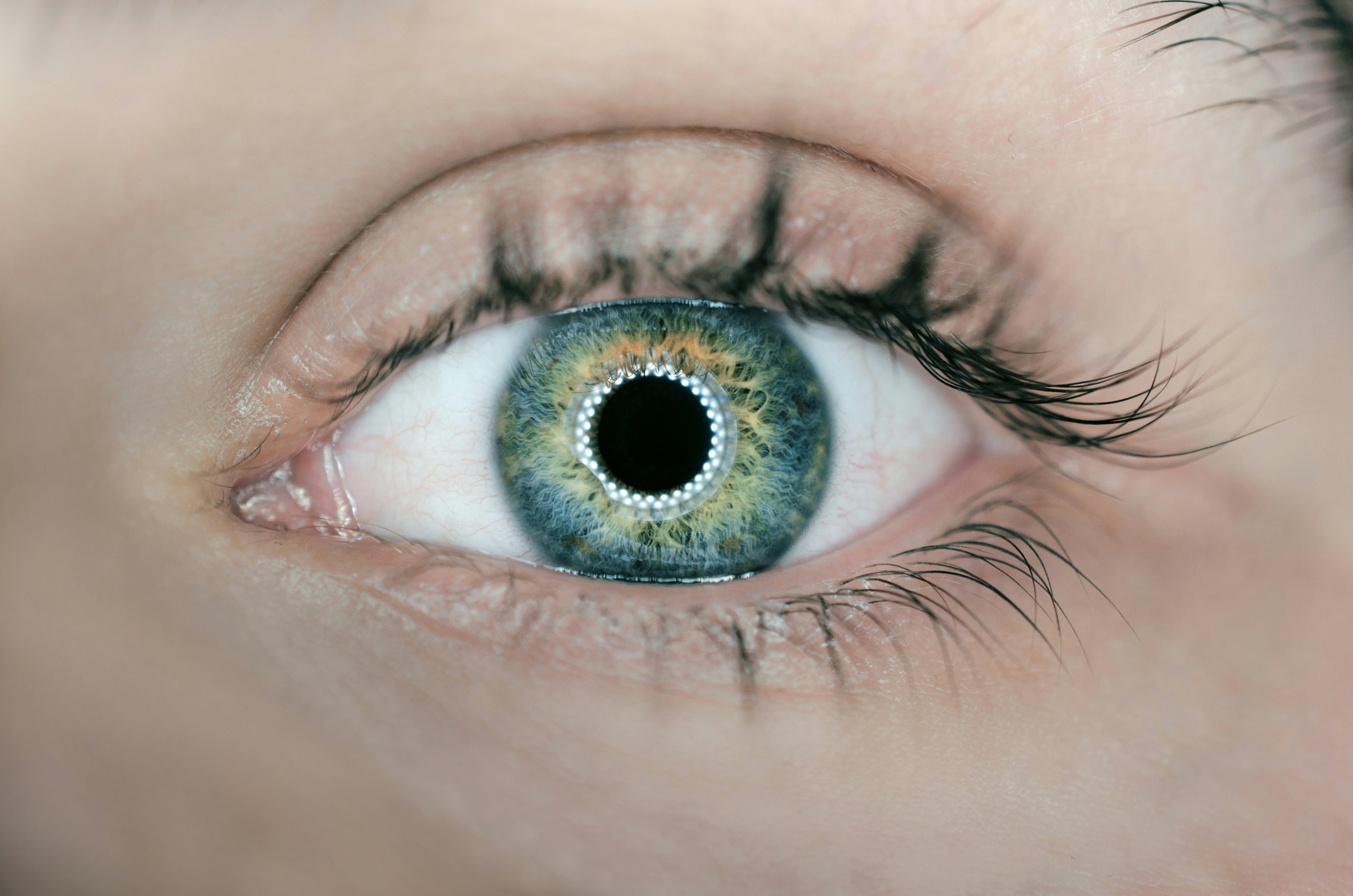 diagnosing blue dot cataract