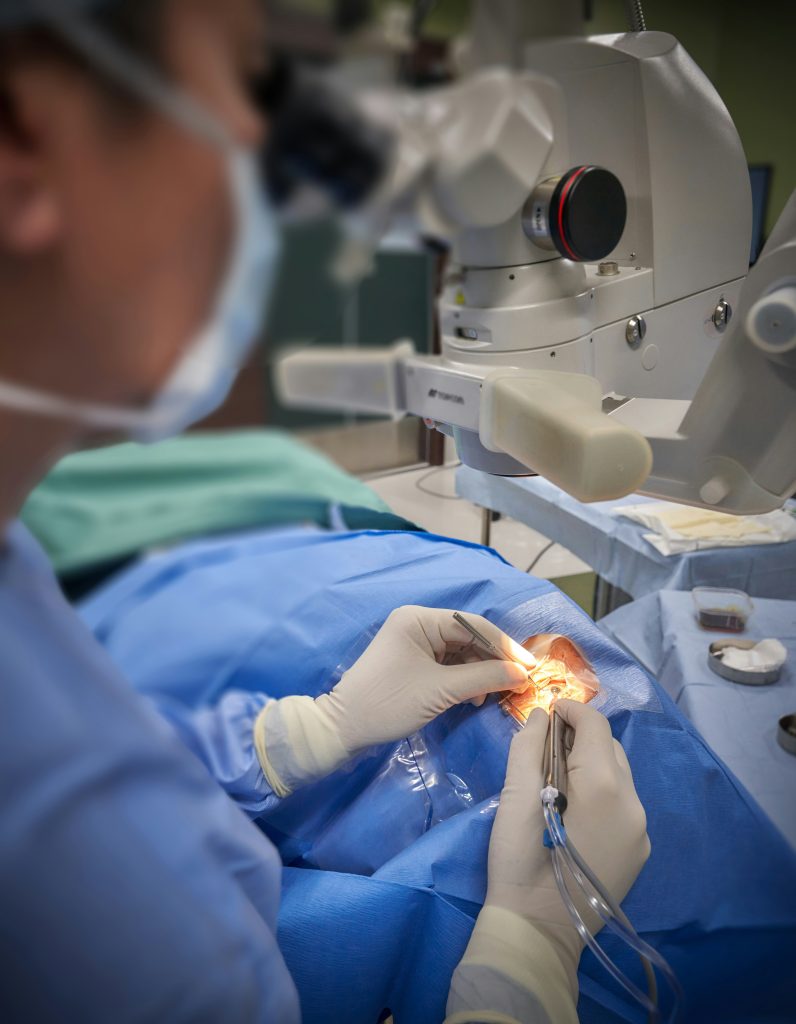 corneal transplant